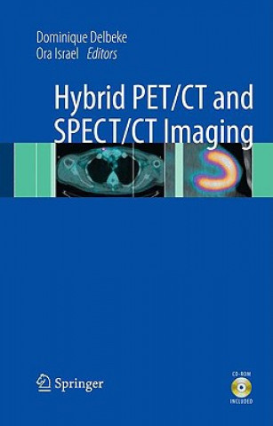 Könyv Hybrid PET/CT and SPECT/CT Imaging Dominique Delbeke