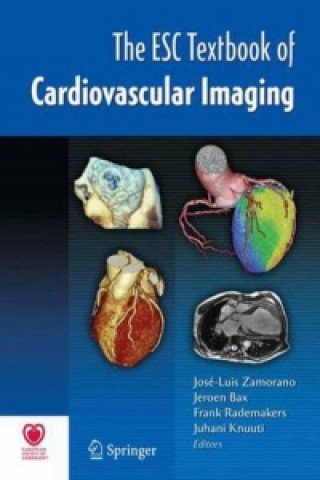 Książka The ESC Textbook of Cardiovascular Imaging J L Zamorano