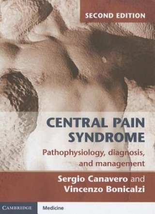 Kniha Central Pain Syndrome Sergio Canavero