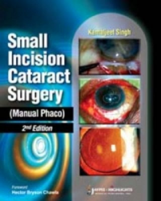 Książka Small Incision Cataract Surgery (Manual Phaco) Kamaljeet Singh