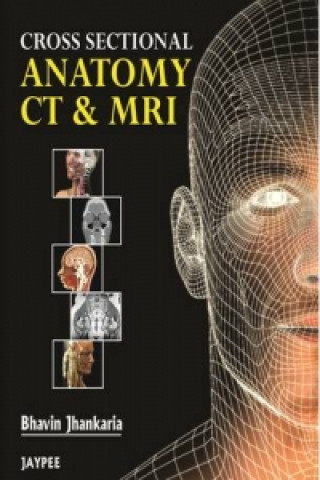 Carte Cross Sectional Anatomy CT and MRI G Bhavin Jankharia