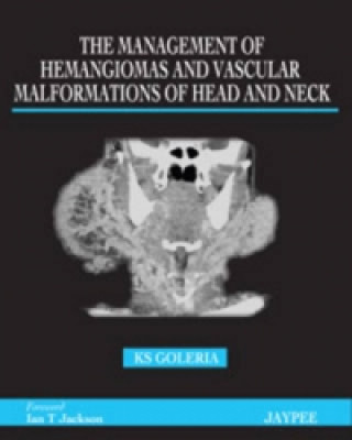 Libro Management of Haemangiomas and Vascular Malformations of Head and Neck K S Goleria