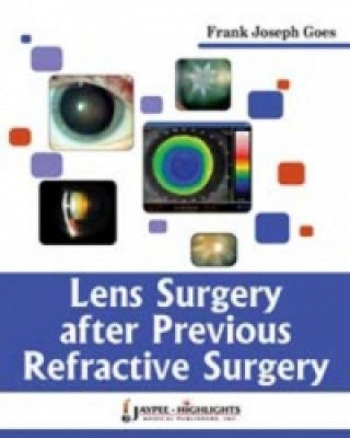 Книга Lens Surgery After Previous Refractive Surgery Frank Joseph