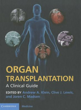 Knjiga Organ Transplantation Andrew Klein