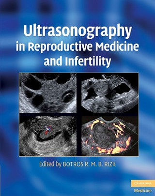 Kniha Ultrasonography in Reproductive Medicine and Infertility Botros R M B Rizk
