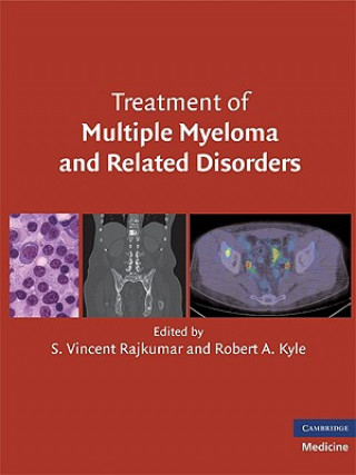 Kniha Treatment of Multiple Myeloma and Related Disorders S Vincent Rajkumar