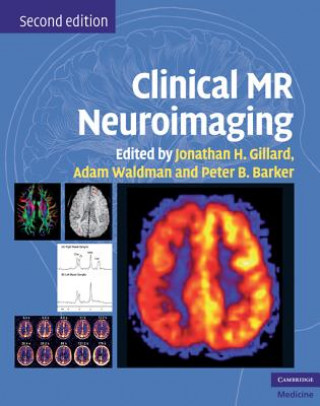 Kniha Clinical MR Neuroimaging Jonathan H Gillard