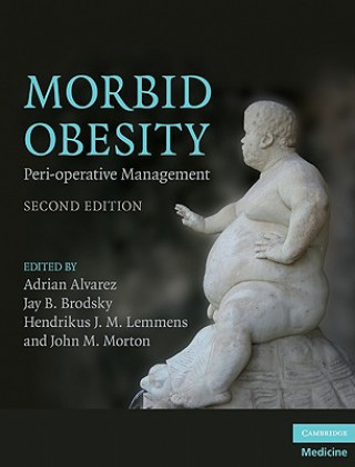 Könyv Morbid Obesity Adrian Alvarez