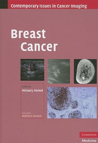 Carte Breast Cancer Michael J Michell