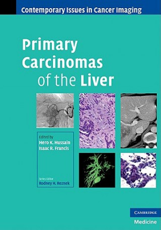 Książka Primary Carcinomas of the Liver Hero K Hussain