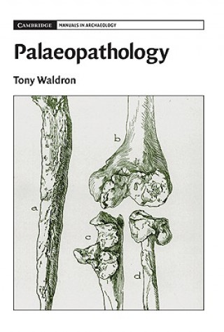 Kniha Palaeopathology Tony Waldron