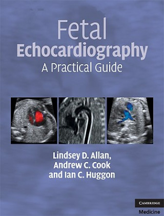 Kniha Fetal Echocardiography Lindsey D Allan