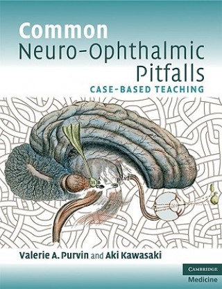 Könyv Common Neuro-Ophthalmic Pitfalls Valerie A Purvin
