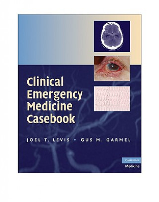 Knjiga Clinical Emergency Medicine Casebook Joel T Levis