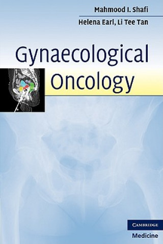 Kniha Gynaecological Oncology Mahmood I Shafi