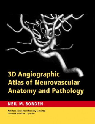 Kniha 3D Angiographic Atlas of Neurovascular Anatomy and Pathology Neil M Borden