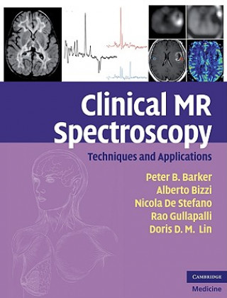 Kniha Clinical MR Spectroscopy Peter B Barker