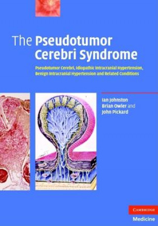 Kniha Pseudotumor Cerebri Syndrome Ian Johnston