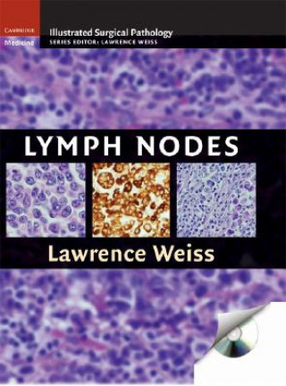 Knjiga Lymph Nodes Lawrence M Weiss