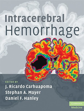 Könyv Intracerebral Hemorrhage J Ricardo Carhuapoma