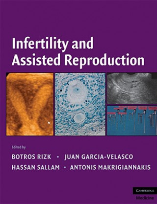 Kniha Infertility and Assisted Reproduction Botros R M B Rizk