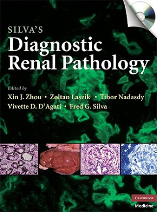 Kniha Silva's Diagnostic Renal Pathology Xin J Zhou