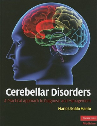 Livre Cerebellar Disorders Mario Ubaldo Manto