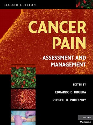 Book Cancer Pain Eduardo D Bruera