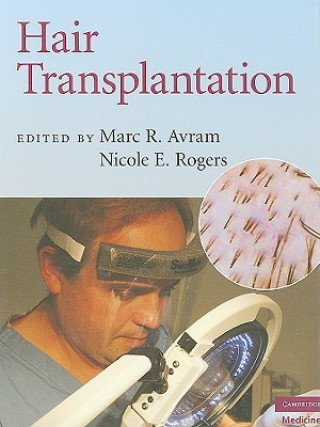 Könyv Hair Transplantation Marc R Avram