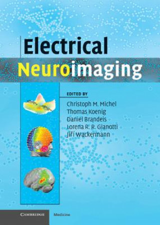 Carte Electrical Neuroimaging Christoph M Michel