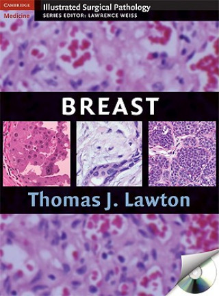 Carte Breast Thomas J Lawton