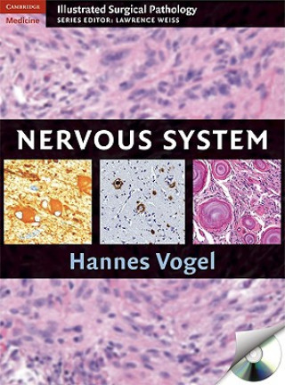 Buch Nervous System Hannes Vogel