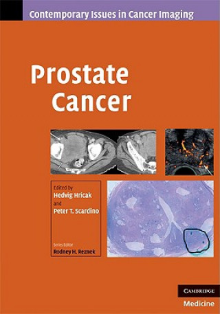 Книга Prostate Cancer Hedvig Hricak