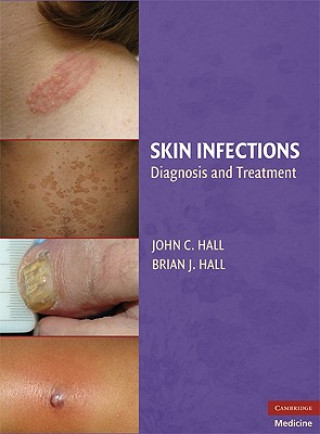 Carte Skin Infections John C Hall