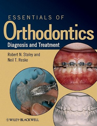 Carte Essentials of Orthodontics - Diagnosis and Treatment Staley