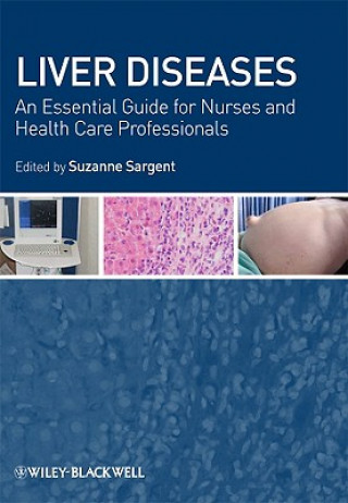 Livre Liver Diseases - An Essential Guide for Nurses and Health Care Professionals Sargent