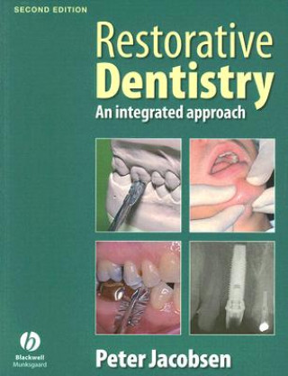 Könyv Restorative Dentistry 2e Jacobsen