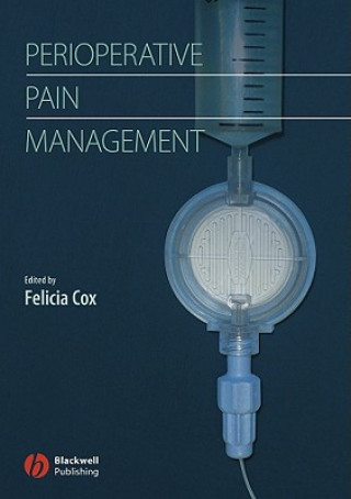 Könyv Handbook of Perioperative Pain Management Cox
