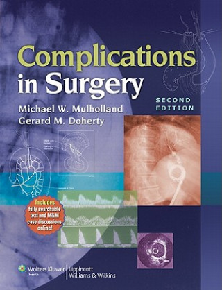 Kniha Complications in Surgery Mulholland