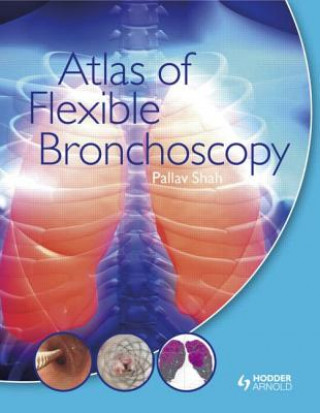 Kniha Atlas of Flexible Bronchoscopy Pallav Shah