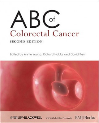 Carte ABC of Colorectal Cancer 2e Annie Young