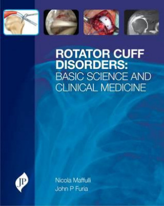 Kniha Rotator Cuff Disorders Nicola Maffulli
