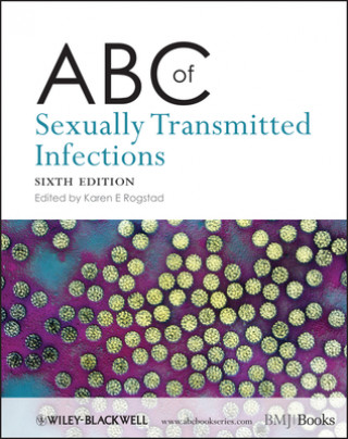 Kniha ABC of Sexually Transmitted Infections 6e Karen Rogstad