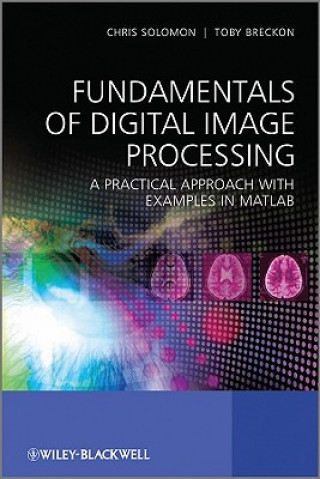 Kniha Fundamentals of Digital Image Processing - A Practical Approach with Examples in Matlab Chris Solomon