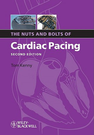 Carte Nuts and Bolts of Cardiac Pacing 2e Tom Kenny