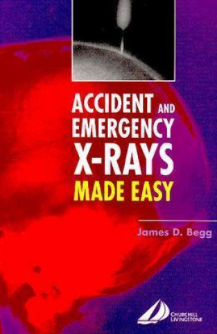 Книга Accident and Emergency X-Rays Made Easy James Begg