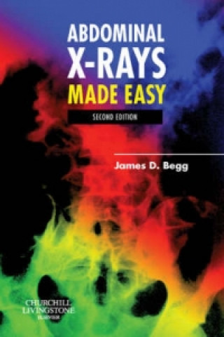 Könyv Abdominal X-Rays Made Easy James D Begg