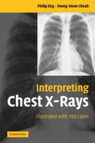 Kniha Interpreting Chest X-Rays Foong-Koon Cheah