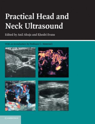 Könyv Practical Head and Neck Ultrasound Anil T. Ahuja