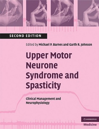 Kniha Upper Motor Neurone Syndrome and Spasticity Michael P Barnes